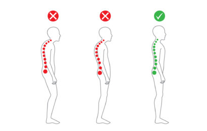 Can A Chiropractor Fix Posture | Chiropractic Adjustment | Posture Correction