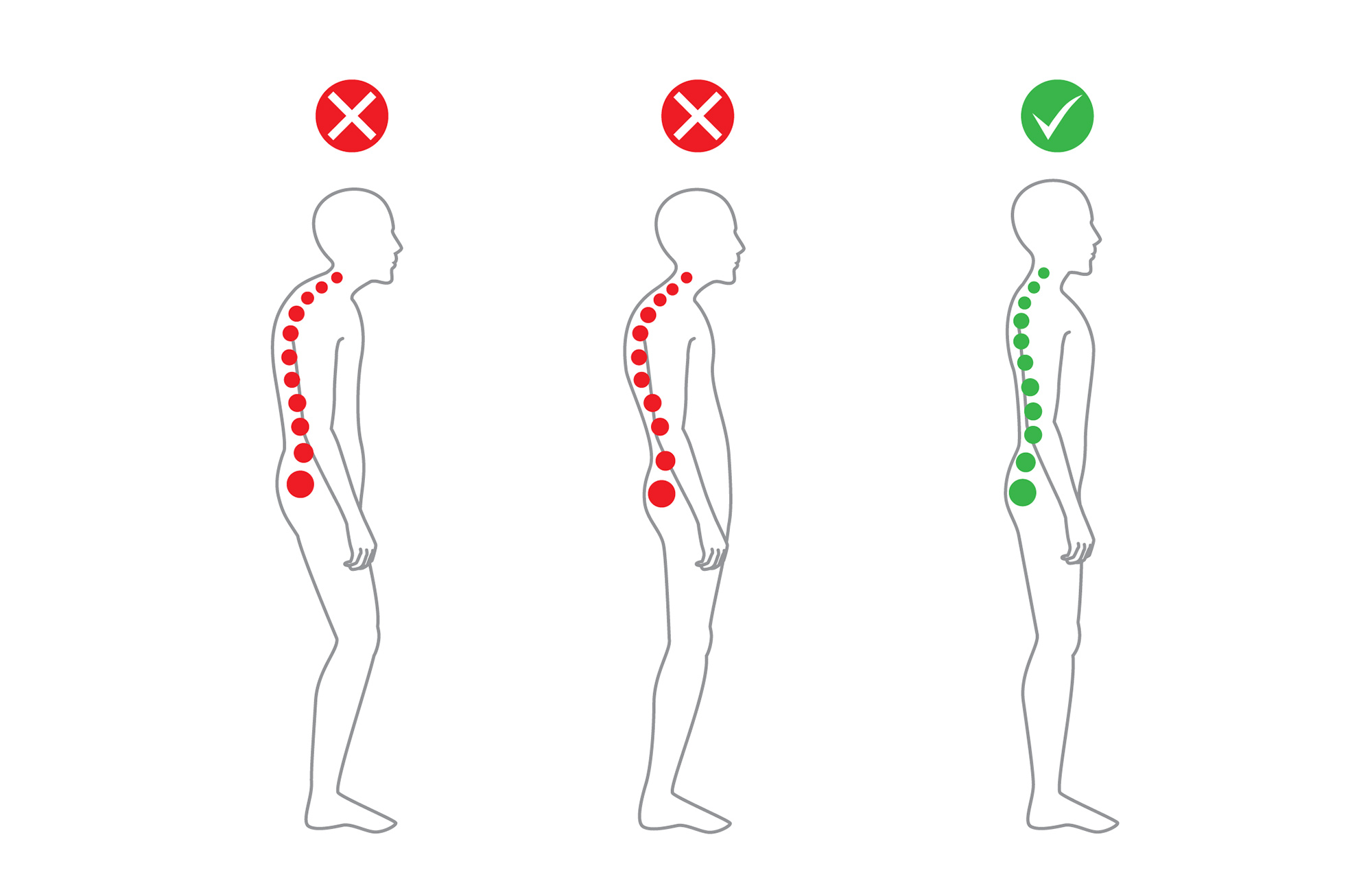 Can A Chiropractor Fix Posture | Chiropractic Adjustment | Posture Correction